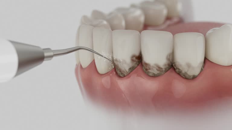 Trusted Tooth Extraction service in Frankenmuth, MI - Dentist Open Now